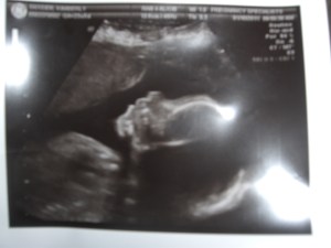 24 weeks 004
