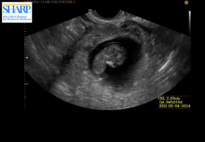 1.2.410.200001.1104.20140104043346250.1.2.2043643.83d923670f4.0000000000